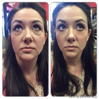 Мгновенный крем Instantly Ageless - Изображение #2, Объявление #1467040
