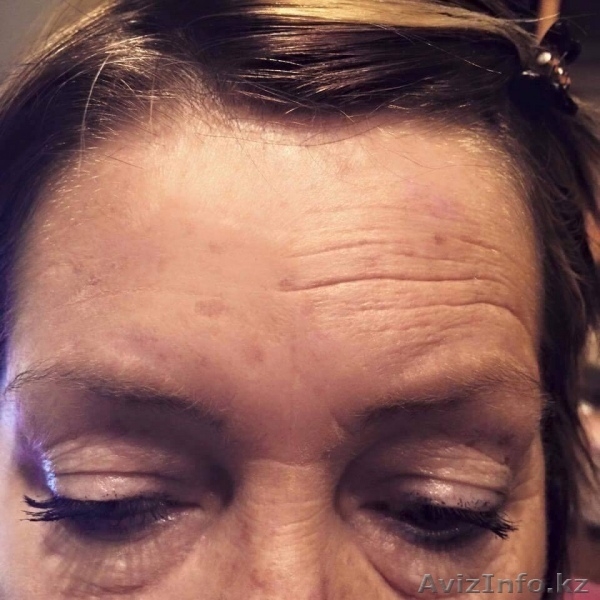 Индустрия омоложения - Изображение #2, Объявление #1467045